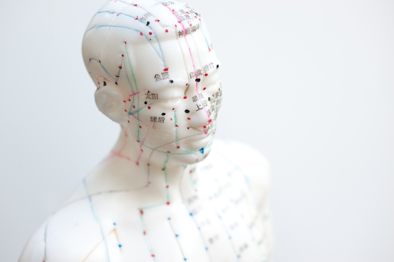 aiguille, acupuncture, agujas acupuntura